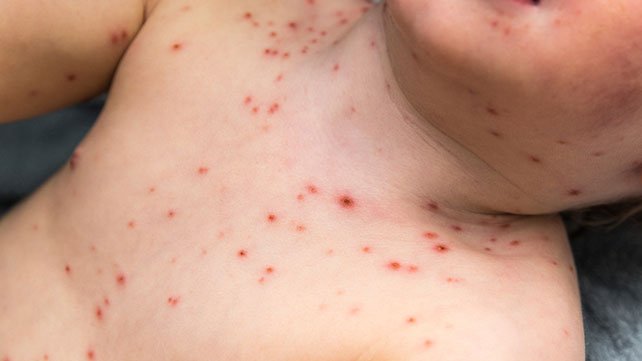 Kịch Tính Mùa Đá Gà Cựa Sắt 2020: Những Trận Đấu Không Thể Bỏ Lỡ